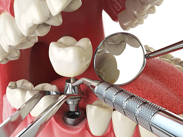 Best Emergency Denture Repair in Fairplains, NC